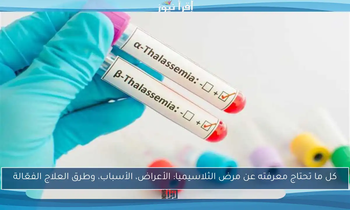 كل ما تحتاج معرفته عن مرض الثلاسيميا: الأعراض، الأسباب، وطرق العلاج الفعّالة