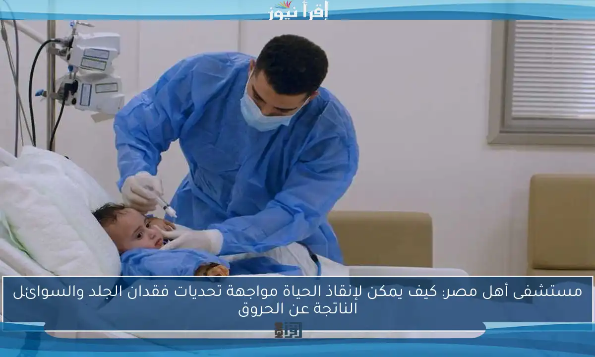 مستشفى أهل مصر: كيف يمكن لإنقاذ الحياة مواجهة تحديات فقدان الجلد والسوائل الناتجة عن الحروق