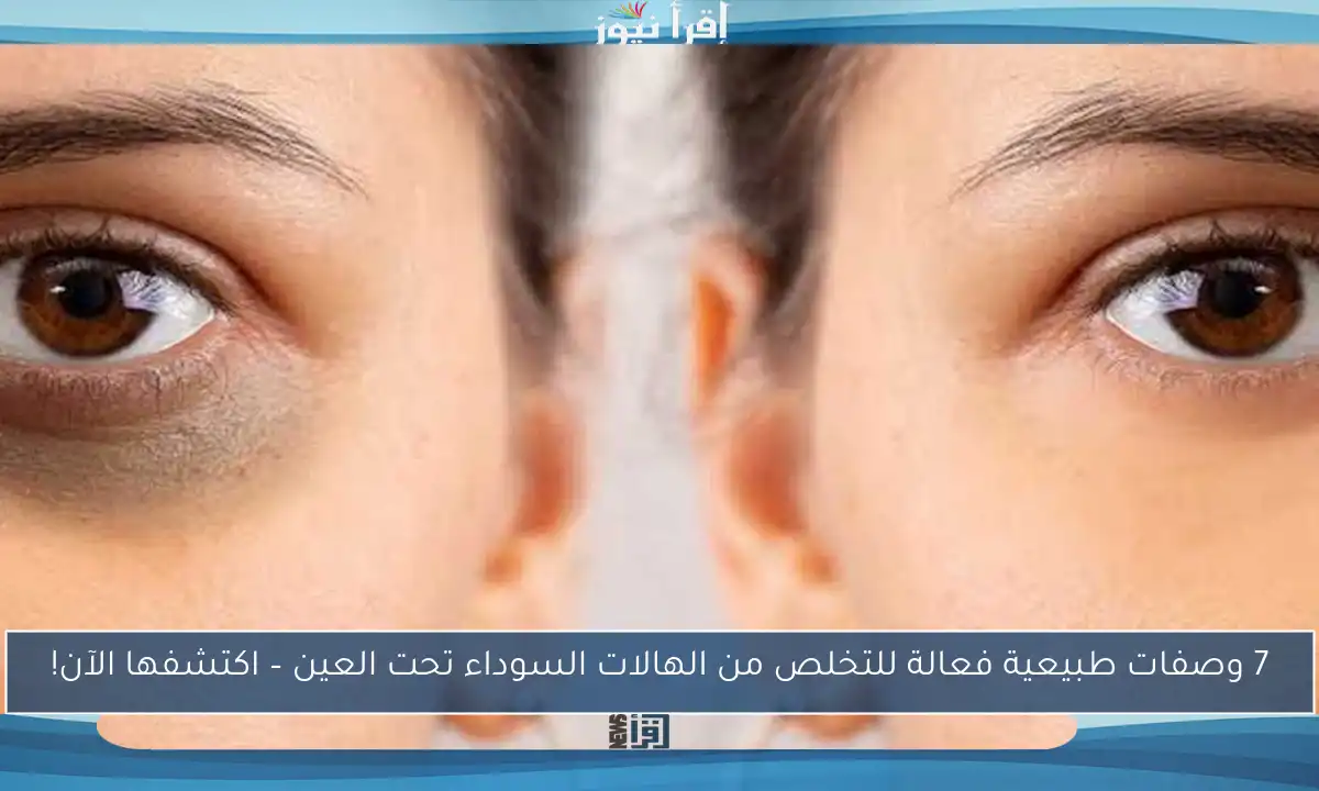 7 وصفات طبيعية فعالة للتخلص من الهالات السوداء تحت العين – اكتشفها الآن!